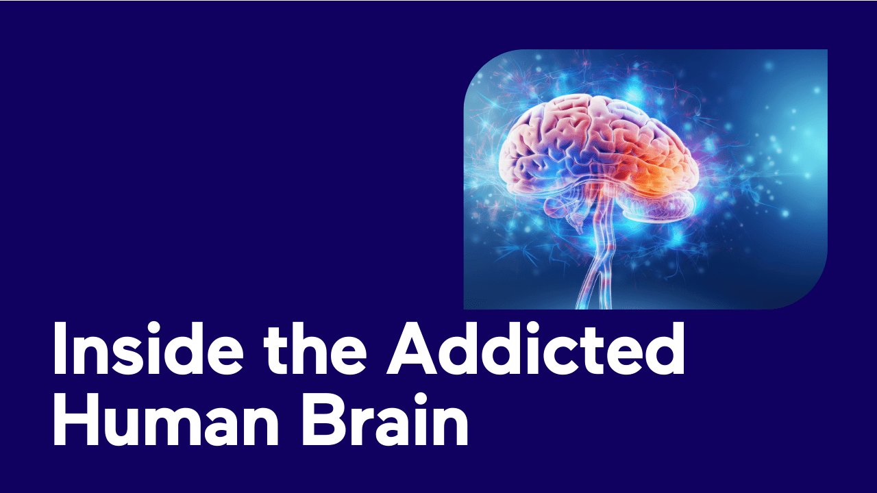 Illustration of a glowing human brain with neural connections, titled 'Inside the Addicted Human Brain'.